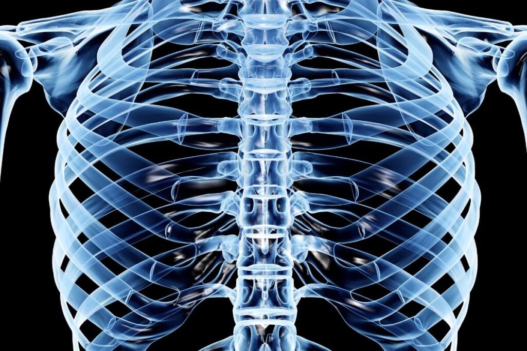 Dysfunctie van de ribgewrichten aan de rugzijde